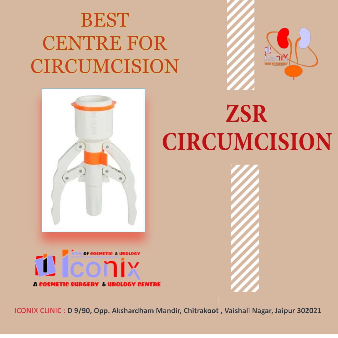 Best ZSR circumcision in Jaipur